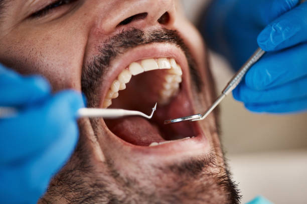 Best Cracked Tooth Emergency Dentist  in Rochester, NY